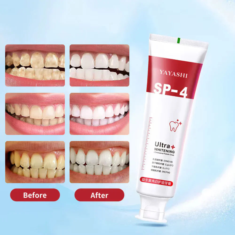 Yayashi SP4 Probiotic Whitening Toothpaste 120g β Removes Coffee, Tea & Smoking Stains + Free Delivery!